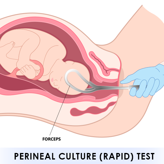 Perineal Culture (Rapid) Test
